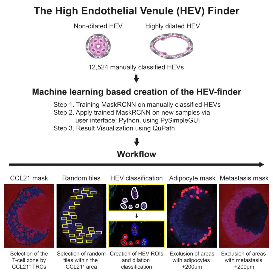 New AI deep learning tool detects changes in blood vessels in cancer ...