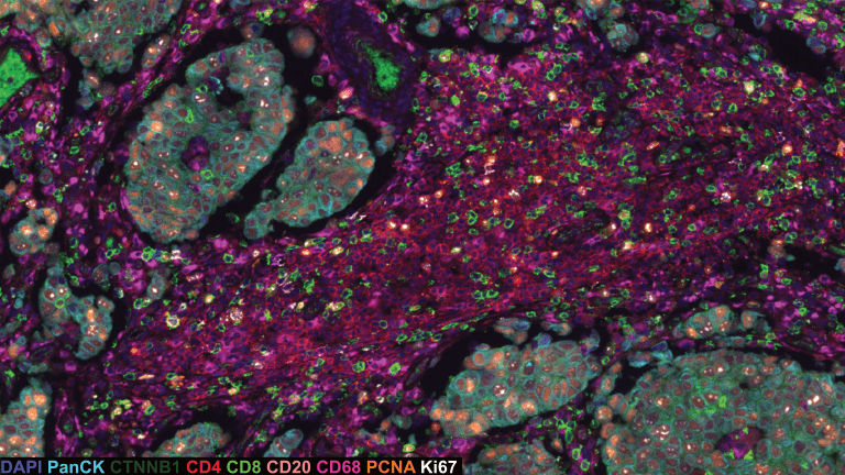 Industry case: SciLifeLab Spatial Proteomics key in enhancing advanced ...