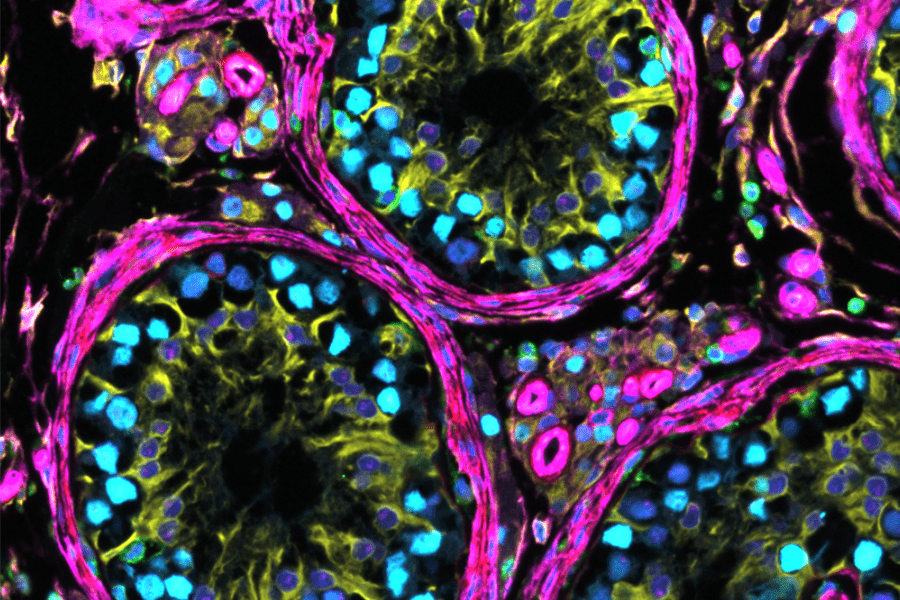 Featured image for The Human Protein Atlas supports Biohub’s global Virtual Biology Initiative for AI-accelerated biology