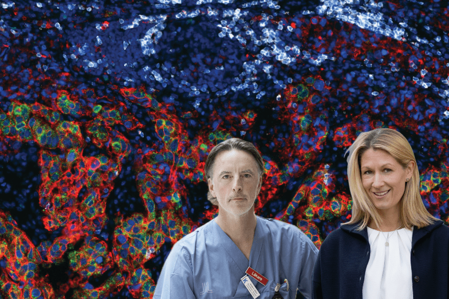 Featured image for Guiding future bladder cancer treatment with spatial proteomics