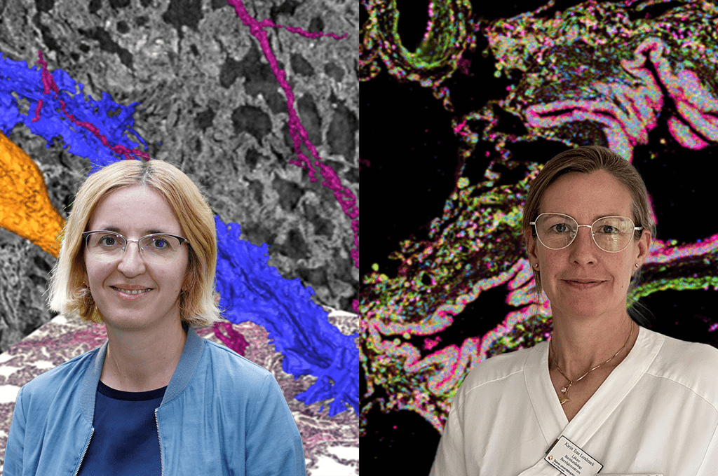 Featured image for Combining 3D imaging and spatial biology to understand pulmonary hypertension